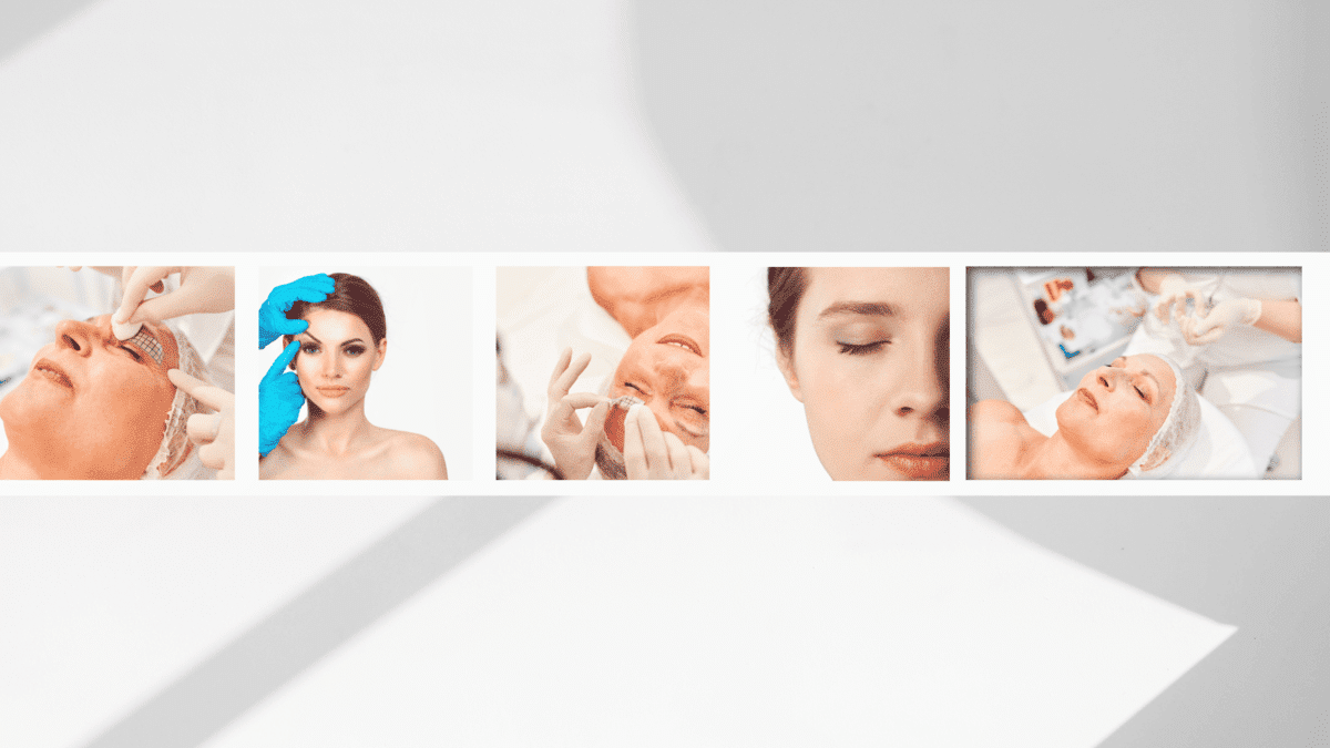 Reveal Your True Self with Eyelid Lift Surgery