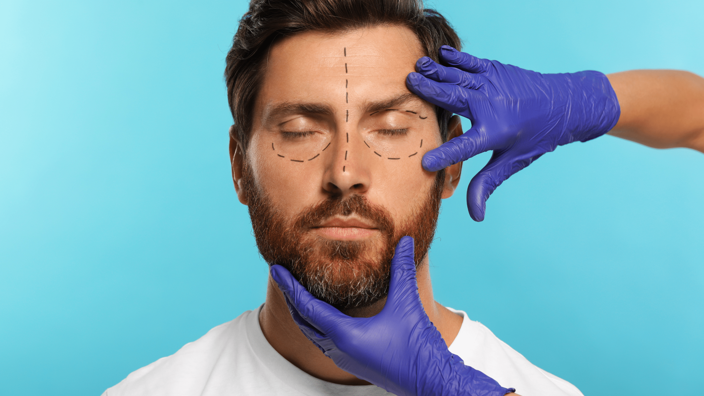 Male blepharoplasty patient