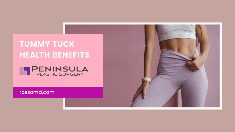 Tummy Tuck Health Benefits: Beyond the Aesthetics