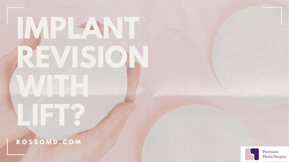 Breast Implant Revision: Do You Always Need a Lift to Get the Results You Want?